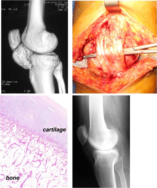 Fig. (1)