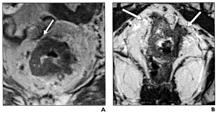 Fig. 12