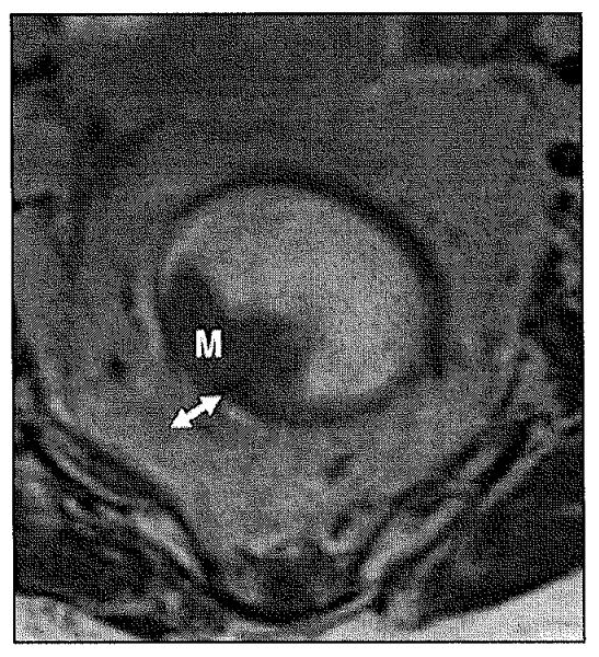 Fig. 11