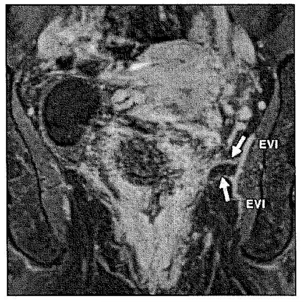 Fig. 13