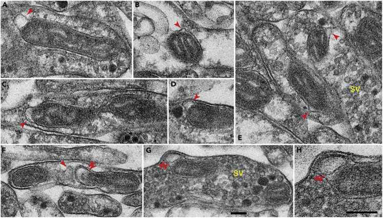 Figure 2