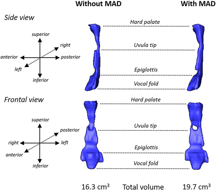 FIGURE 3