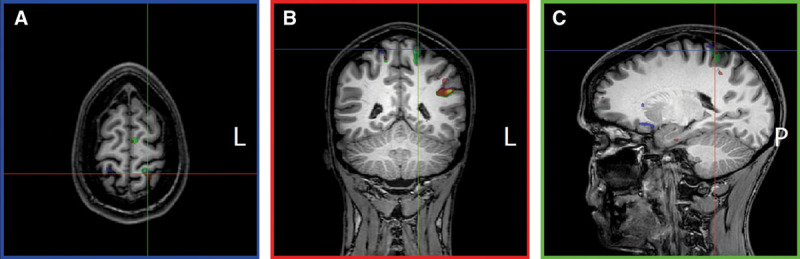 Fig. 2.