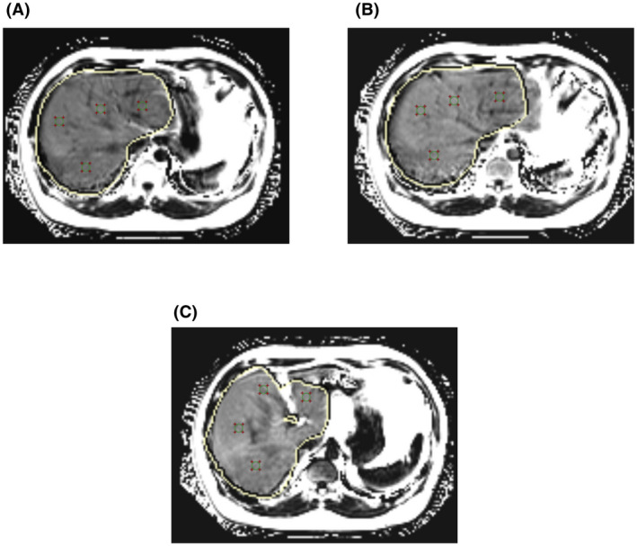 FIGURE 2