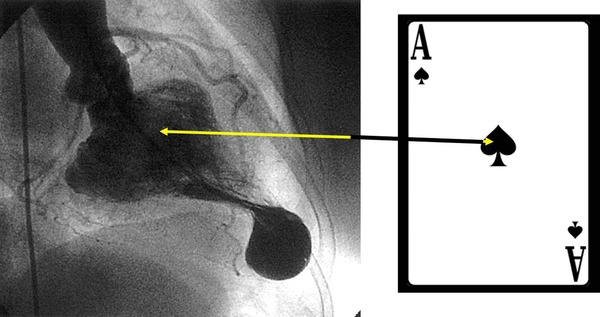 Figure 14