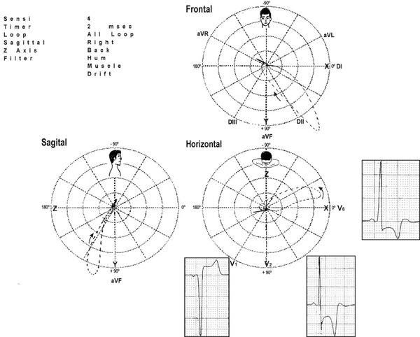 Figure 13