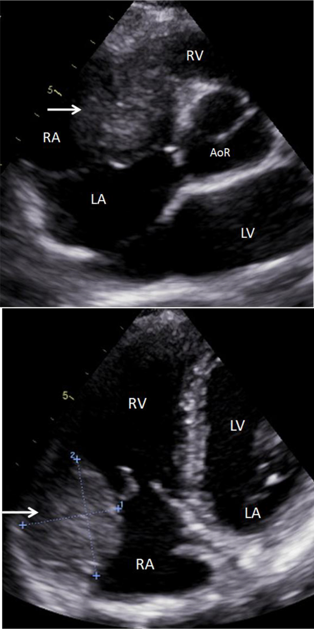 Fig. 1