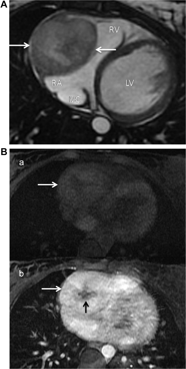 Fig. 3