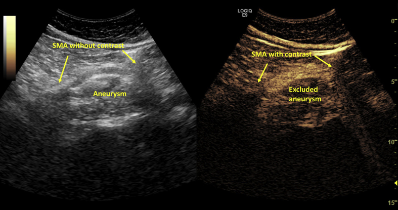 Figure 3