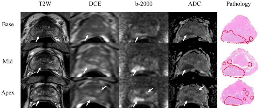 FIGURE 1: