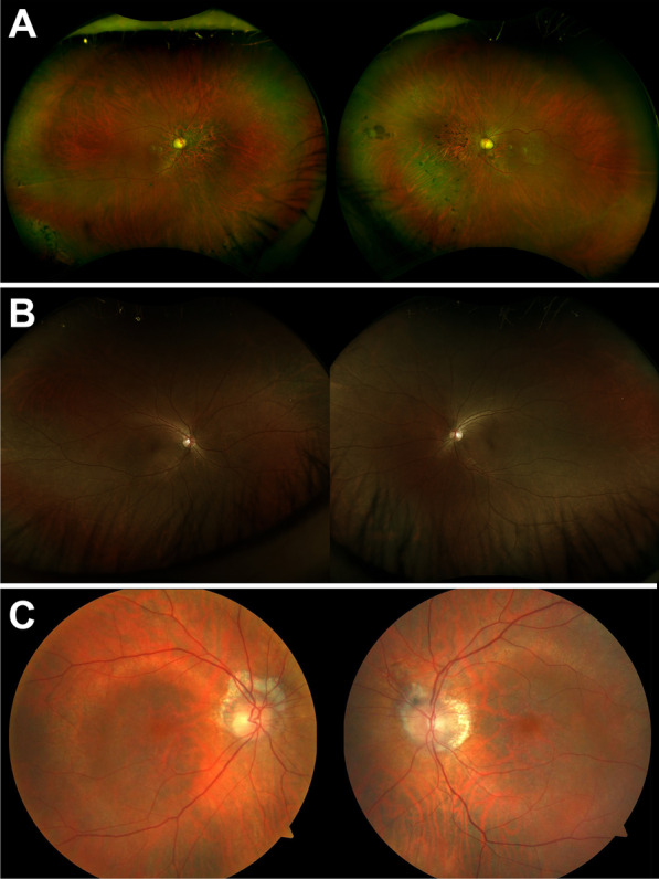 Fig. 1