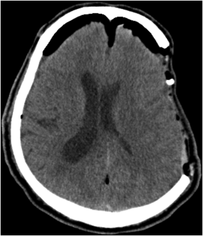 Fig. 2