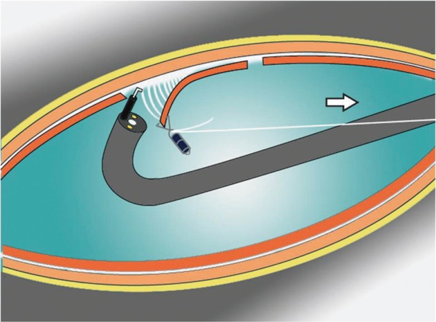 Fig. 1