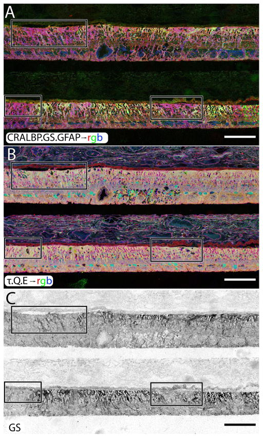 Figure 11