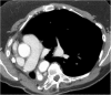 Fig. 11