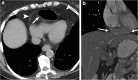 Fig. 14