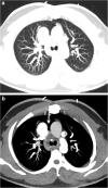 Fig. 8