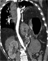 Fig. 22