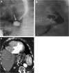 Fig. 15