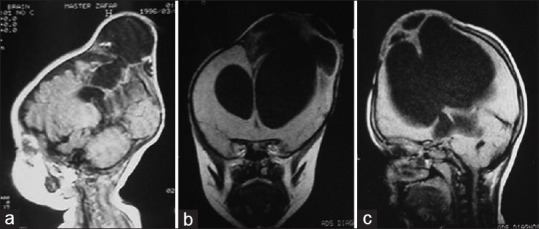 Figure 17