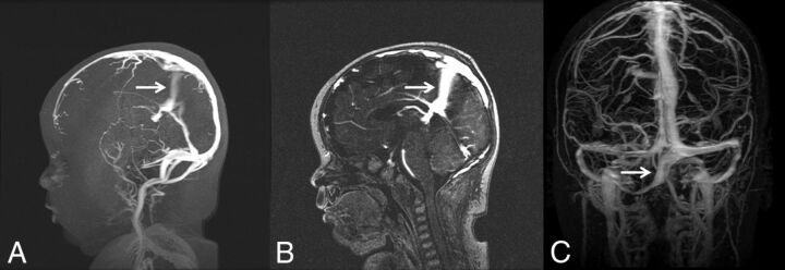 FIG 5.