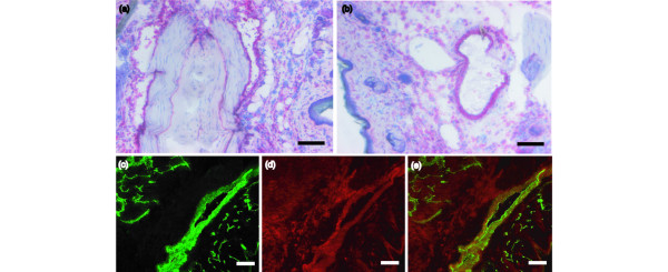 Antibody-mediated delivery of IL-10 inhibits the progression of ...