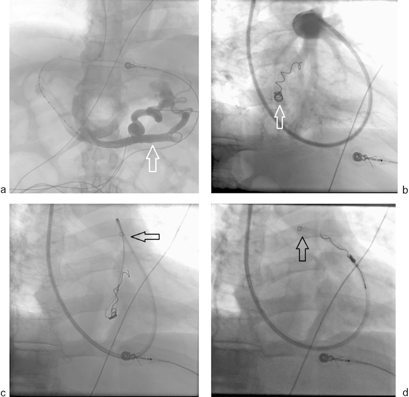 Fig. 10