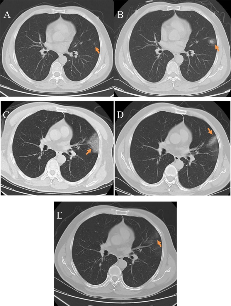 Fig. 1