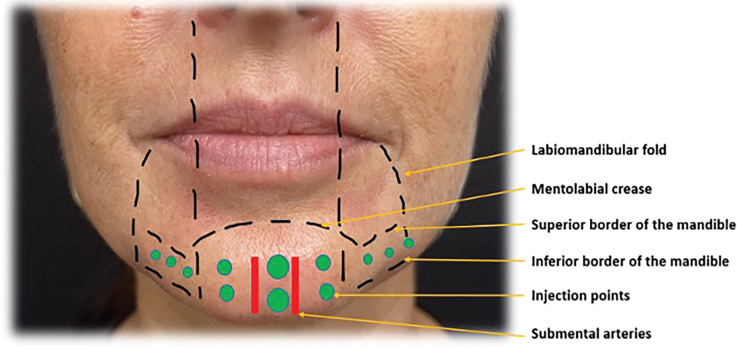 FIGURE 1.