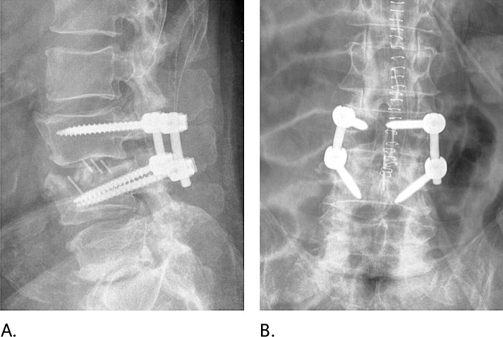 Figure 13.