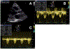 Fig 2.