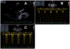 Fig 3.