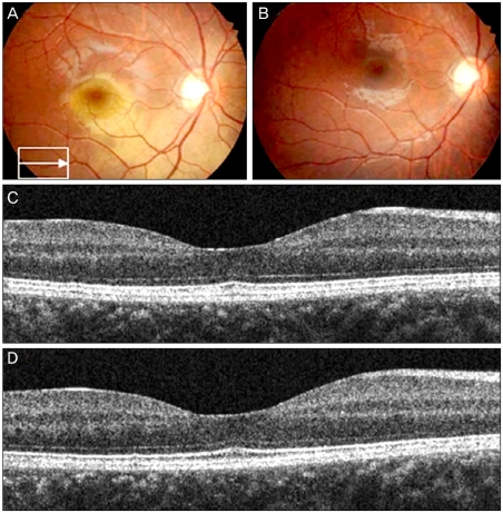 Fig. 2