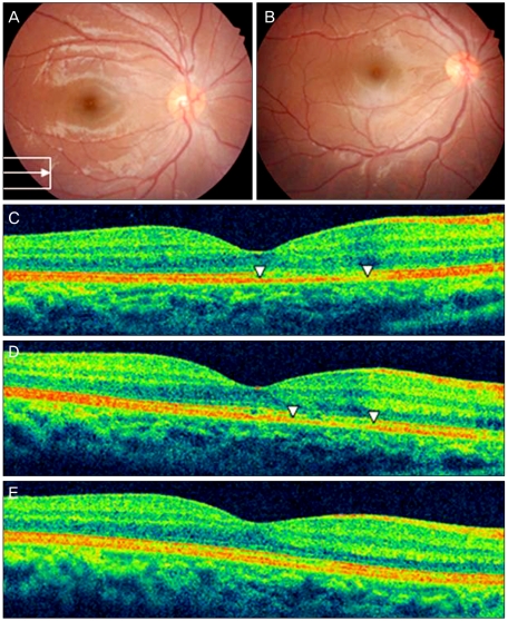 Fig. 3