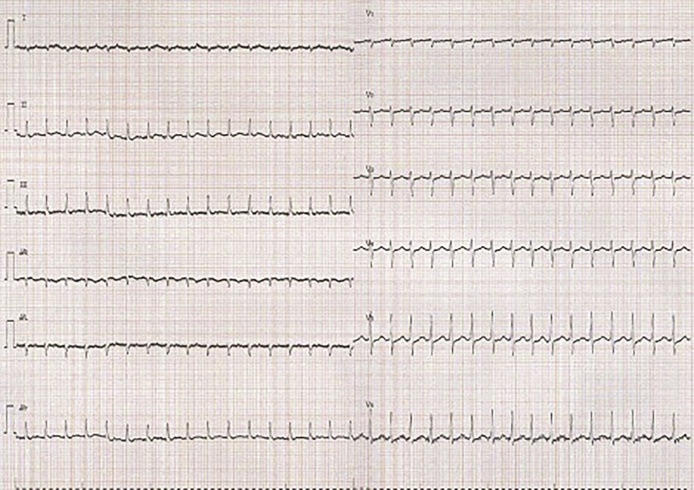 Fig. 2