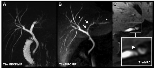 Figure 14