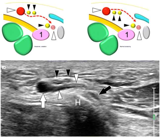 Fig. 21