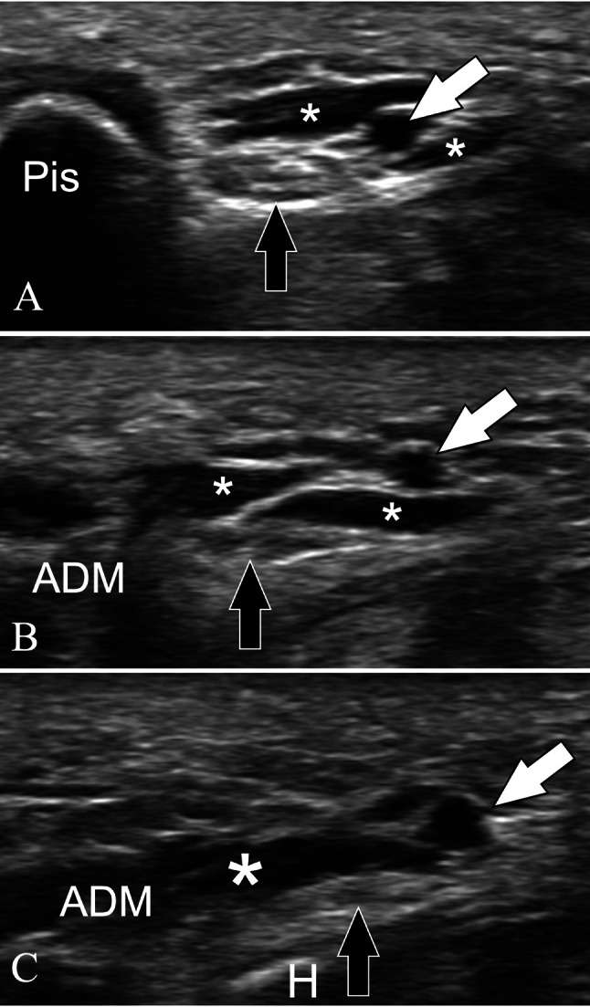 Fig. 17