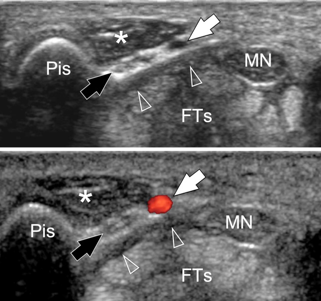 Fig. 15