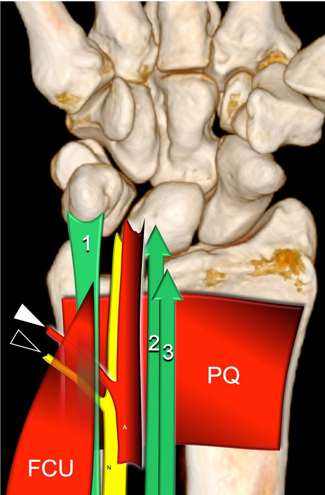 Fig. 2