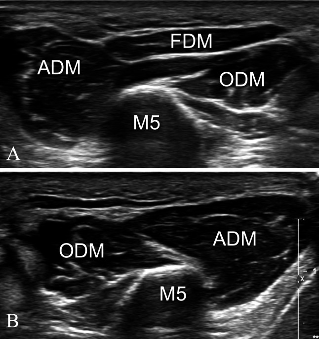 Fig. 18