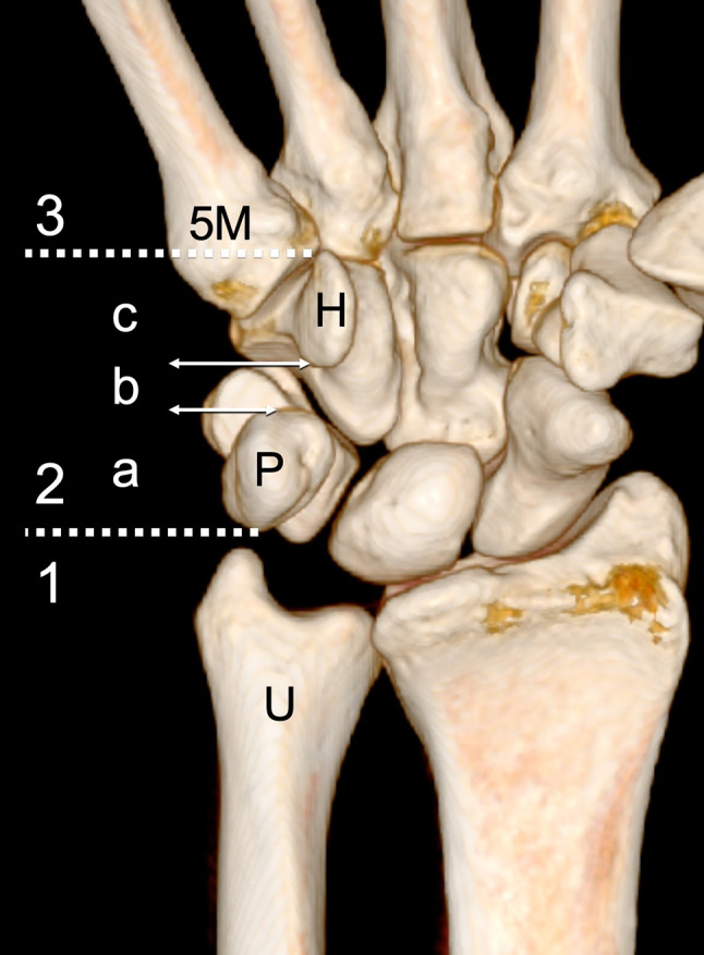 Fig. 1