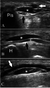 Fig. 16