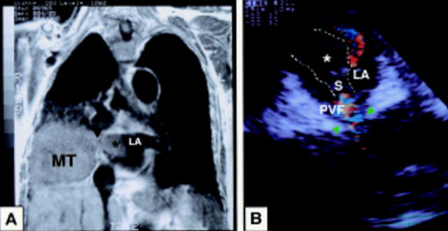 Figure 1  