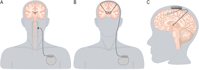 Fig. 1