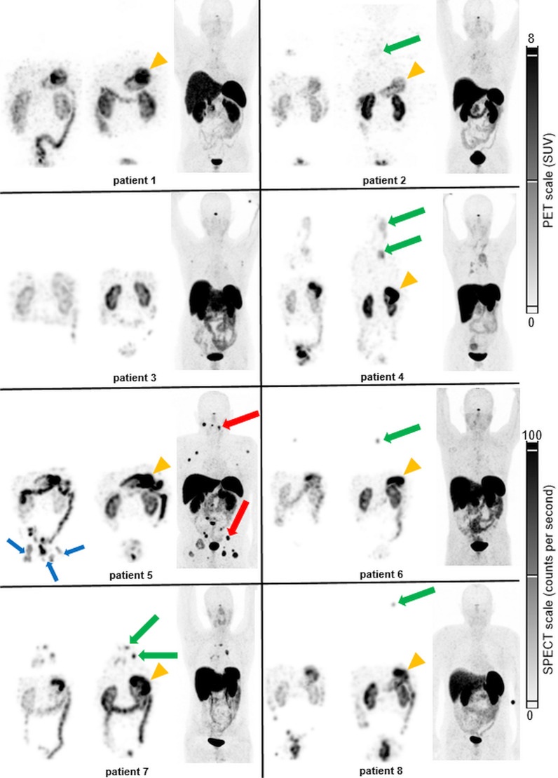 Fig. 2