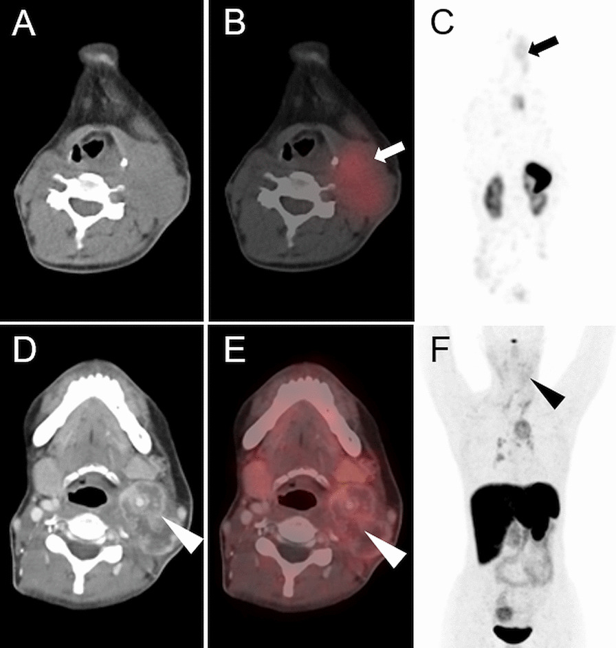 Fig. 3