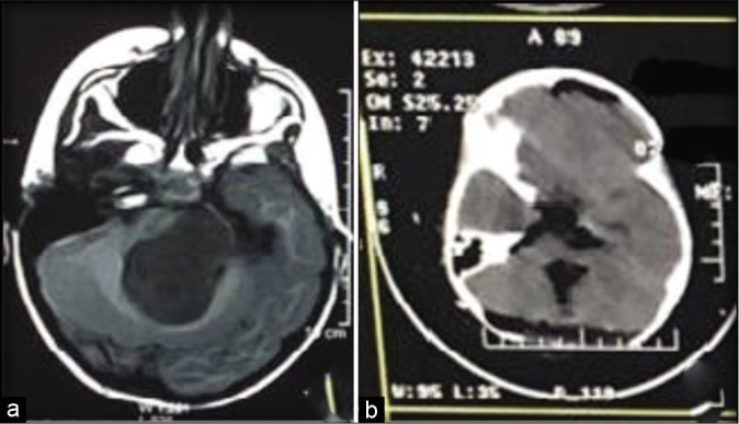 Figure 2: