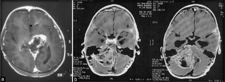 Figure 1: