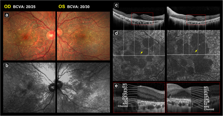 Fig. 3